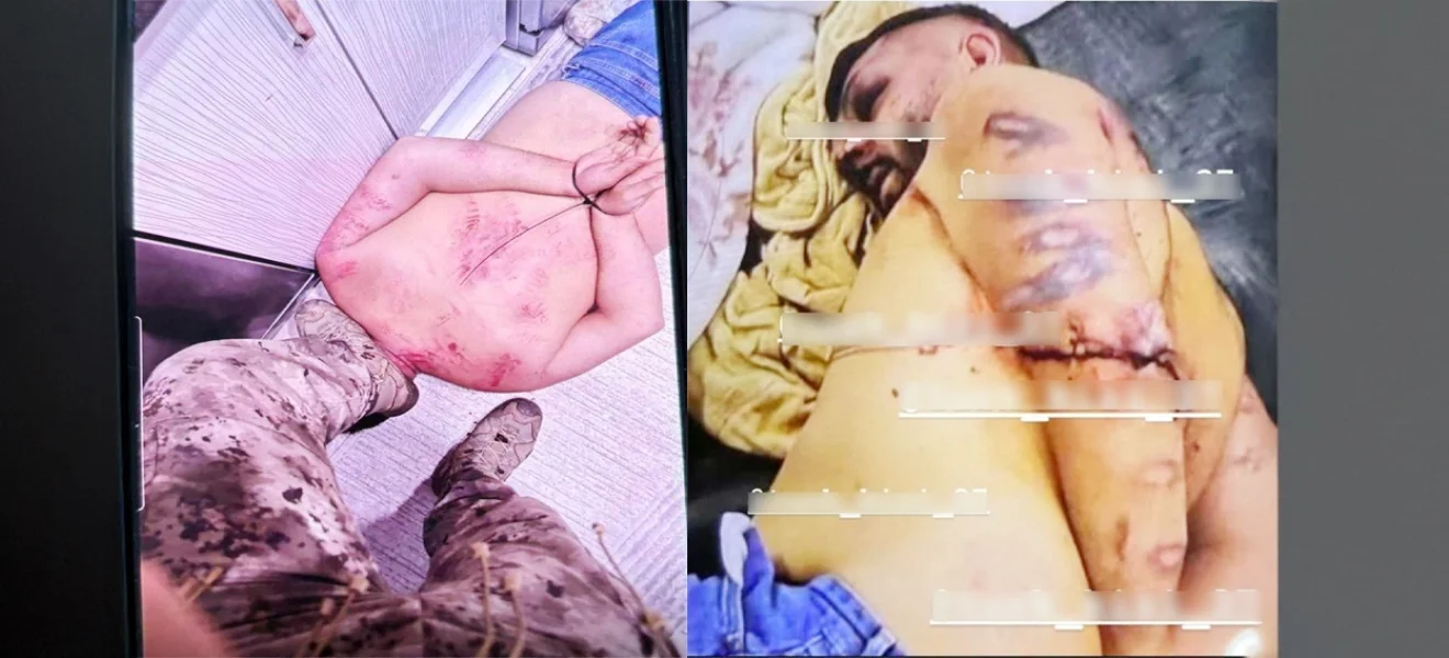 Başsavcılık işkenceyi önemsemedi