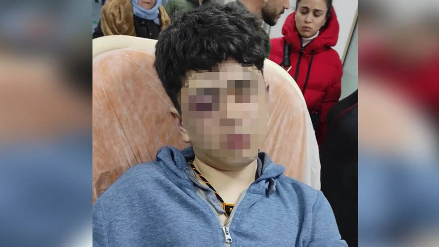 Lice’de polisten işkence gören 14 yaşındaki Y.D.
