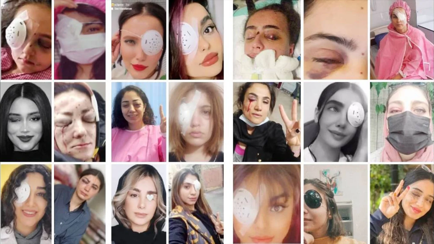 Jîna Emînî eylemlerinde gözlerini kaybedenler