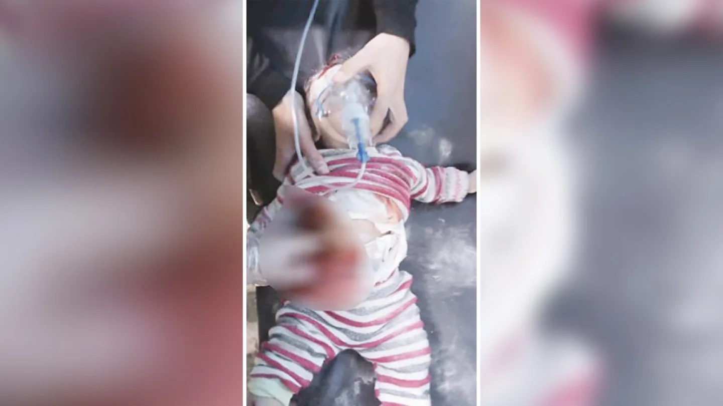 Türk işgal saldırılarında katledilen bebek
