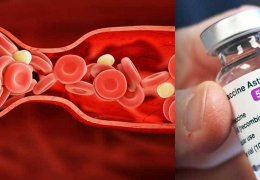 Kan pıhtılaşması 