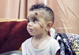 Bitmeyen savaşta yıkım büyüyor