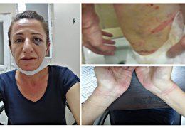 İşkenceden sonra esaret