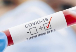 Virüs 2 aydan fazla süre bulaşıcı