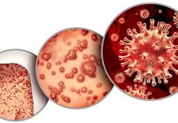 Maymun çiçeği 71 ülkede tespit edildi