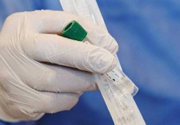 Ankara’da günlük bine yaklaştı