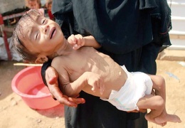 Yemen’de kıtlık yaşanıyor