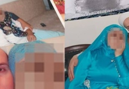 Bir istismarın anatomisi