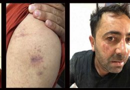 İşkenceli gözaltıdan sonra tutuklama