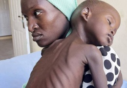 735 milyon insan açlık çekiyor