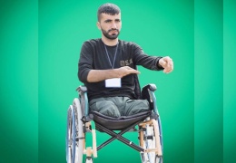 Gözümü açtım, iki ayağım yoktu