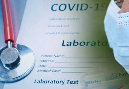 Başvuru çok, kit yok