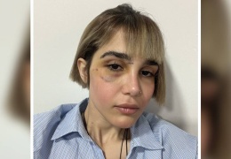 Maroofian: Acılarımızı iyileştireceğiz
