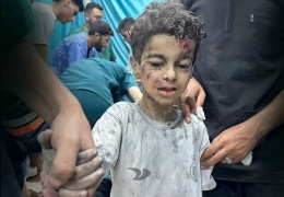 Sömürgeciliği koruma hakkı