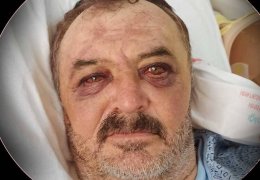 Gözaltından yoğun bakıma suç duyurusu