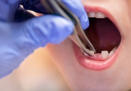 Çocukların diş sağlığı