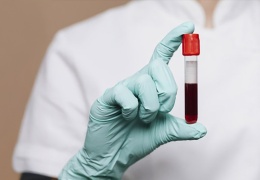 Transfüzyon riskleri