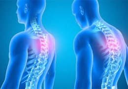 Scheuermann hastalığı