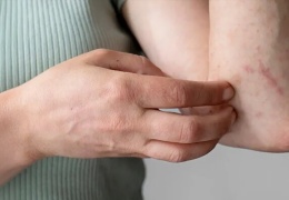 Erişkin Still hastalığı