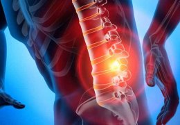 Bel omuru bölgesinde bel fıtığı ameliyatı