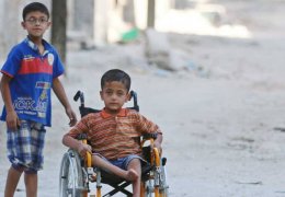 25 bin kişi uzuvlarını kaybetti 4 bin 500 kişi protez bekliyor