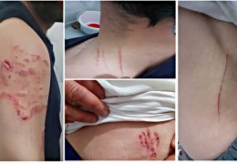 Polisten köpekli işkence