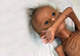 400 bin çocuk açlığın pençesinde