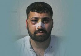 Bu, polise mukavemet mi?