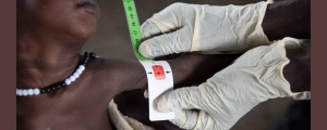 Afrika’da 1,5 milyon çocuk tedavi göremiyor