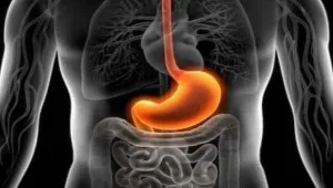Gastrit