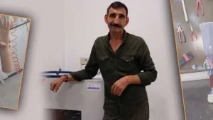 5 bin 760 kişinin proteze ihtiyacı var