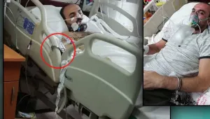 Entübede kelepçe