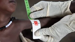 Afrika’da 1,5 milyon çocuk tedavi göremiyor