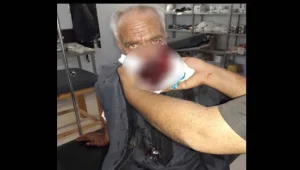 Eyn Îsa ve Girê Spî'de 60 şehit ve yaralı