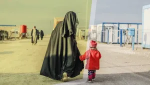 Feyza, yanık izleriyle yaşam kurdu