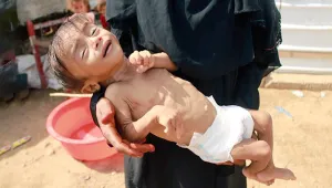 Yemen’de kıtlık yaşanıyor