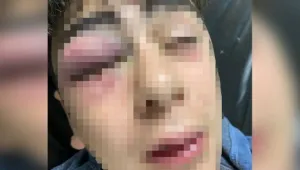 Kamera o an bozukmuş!