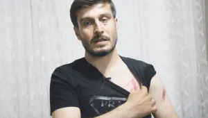Polis önünü kesip darp etti