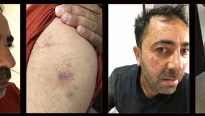 İşkenceli gözaltıdan sonra tutuklama
