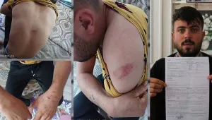 Kaçırılıp işkence edildi