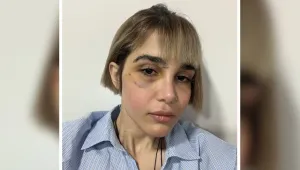 Maroofian: Acılarımızı iyileştireceğiz