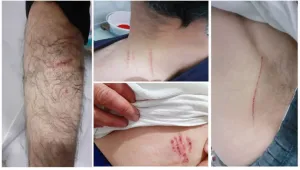 Köpekli işkence ‘kusursuz’ bulundu