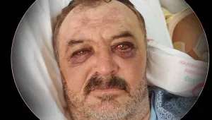 Gözaltından yoğun bakıma suç duyurusu