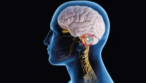 Trigeminal Nevralji 