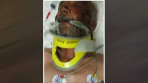 18 gündür yoğun bakımda