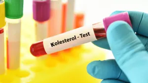 Yüksek kolesterol 
