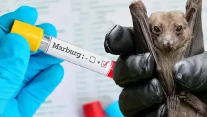 Marburg virüsü hastalığı
