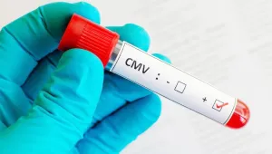 Sitomegalovirüs (CMV)