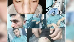 İşkence raporuna gözaltı