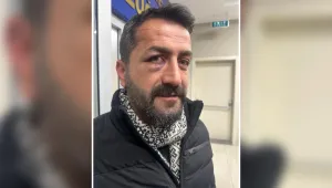 Polis şiddeti nedeniyle görme kaybı yaşıyor